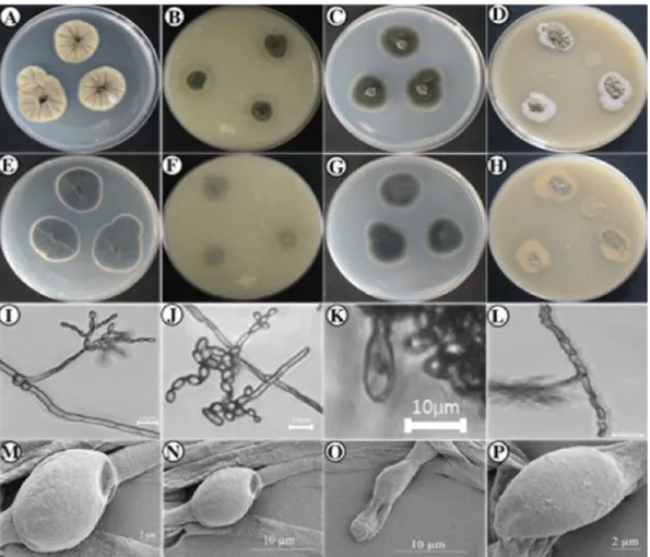 Fig. 12. Morphological characters of Sporothrix inflata (KNU15-20) grown for 7 days on PDA, OA, CYA and YES at 26 o C