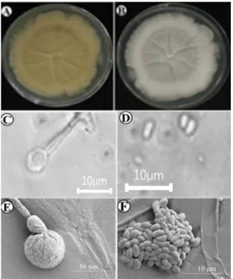 Fig. 15. Morphological characters of Xylogone sphaerospora (KNU15-7) grown for 7 days on potato dextrose agar