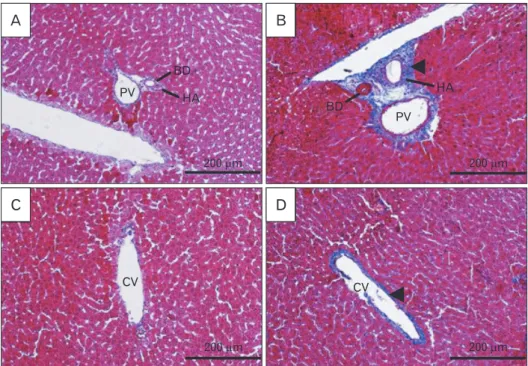Fig. 5. Fibrotic changes of liver following  formaldehyde (FA) administration in  comparison with control in Masson’s tri­