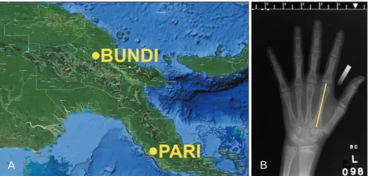Fig. 1. (A) Map of Papua New Guinea,  depict ing the regions where Bundi  High land Village and Pari Coastal  Village are located (Map data ©2018  Google)