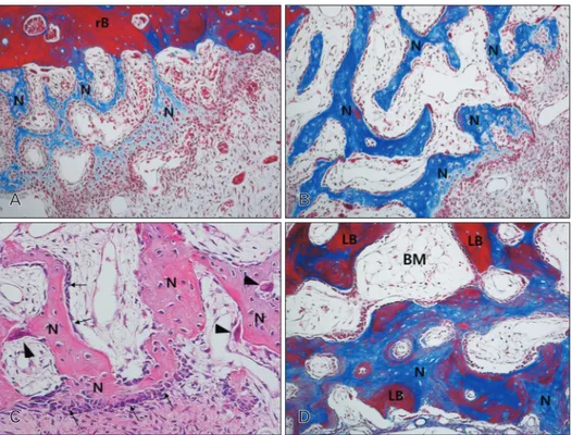 Fig. 2. Photomicrograph showing the bone formation of the group 1 at 2 weeks (A), 4 weeks (B, C), and 8 weeks (D)