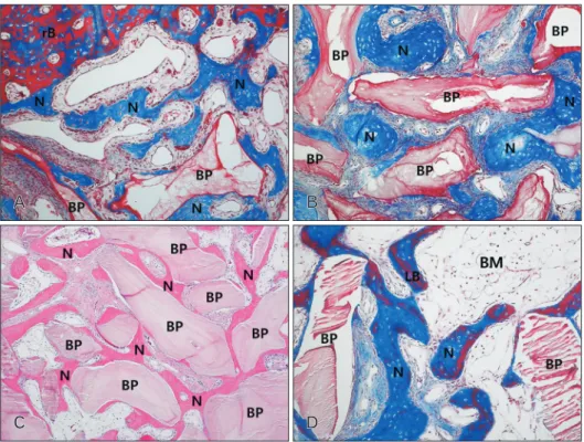 Fig. 3. Photomicrograph showing the bone formation of the group 2 at 2 weeks (A), 4 weeks (B), and 8 weeks (C, D)