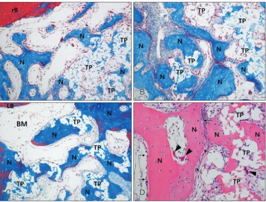 Fig. 4. Photomicrograph showing the bone formation of the group 3 at 2 weeks (A), 4 weeks (B), and 8 weeks (C, D)
