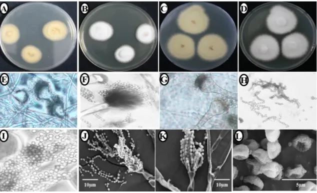 Fig. 4. Morphological characterization of Neosartorya aureola  KNU14-7  observed using a compound microscope and scanning electron microscope (SEM)