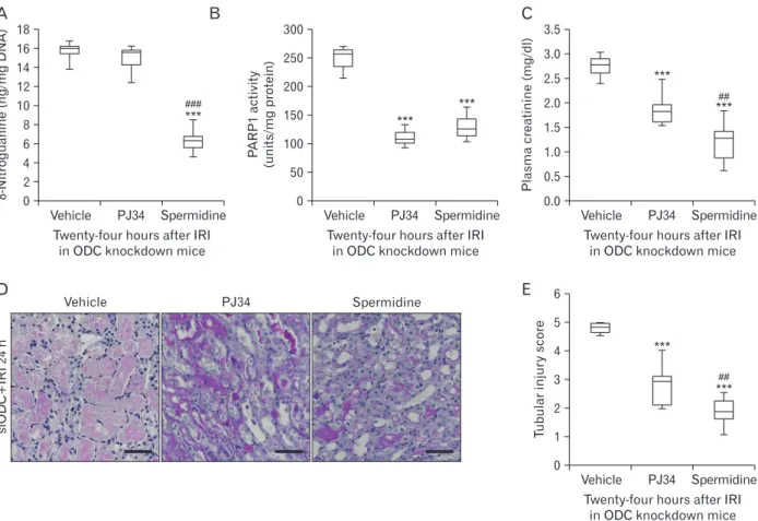 Fig. 4. Exogenous spermidine attenuates tubular damage and kidney dysfunction after ischemia and reperfusion injury (IRI) through inhibiting  DNA nitration and poly(ADP-ribose) polymerase 1 (PARP1) activation