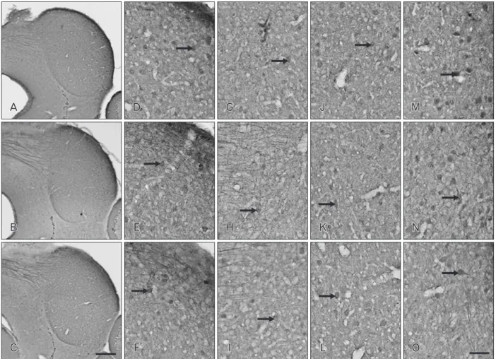 Fig. 2. Distribution of parvalbumin (PV) immunoreactivity (IR) in coronal sections through the inferior colliculus (IC) of postnatal day 16 wild- wild-type (+/+) (A, D, G), heterozygous (+/cir) (B, E, H), and homozygous (cir/cir) (C, F, I) mice