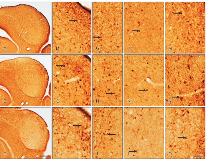 Fig. 3. Distribution of calretinin (CR) immunoreactivity (IR) in coronal sections through the inferior colliculus (IC) of postnatal day 16 wild-type  (+/+) (A, D, G), heterozygous (+/cir) (B, E, H), and homozygous (cir/cir) (C, F, I) mice