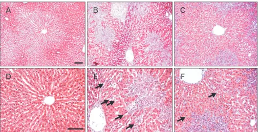 Fig. 1. Protective effect of Rhus verniciflua Stokes (RVS) on bile duct ligation (BDL)–induced hepatic parenchymal injury