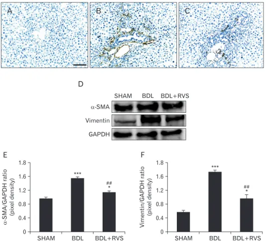 Fig. 3. Attenuation of bile duct ligation (BDL)–induced myofibroblast activation by Rhus verniciflua Stokes (RVS) treatment