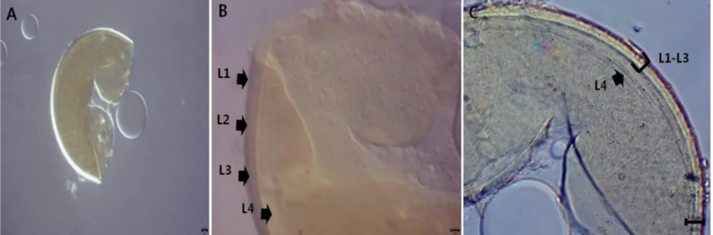 Fig. 4.  Diversispora aurantium (CN14129). A, B, spore and subtending hyphae; C, D, spore wall structure