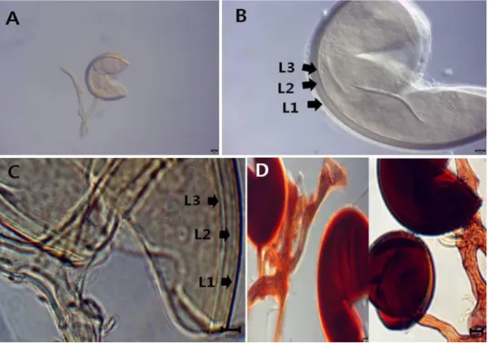 Fig. 6.  Rhizophagus irregularis (CN14040). A, spore and subtending hyphae; B, C, spore structure in PVLG; D, spores and subtending hypae in Melzer's reagent