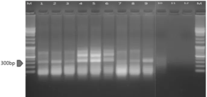 Fig. 3. An electrophoresis of Agro-infiltration in tobacco. It was  analyzed insert from 3 genes selected from cDNA library of  tobacco whitefly on agarose gel for insert detection