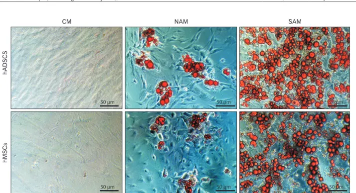 Fig. 1. Oil-Red staining after 21 days (×20). Staining after 10 days not shown. hADSC, human adipogenic-derived stroma cell; hMSC, human  bone marrow mesenchymal stroma cell; CM, culture medium; NAM, normal adipogenic medium; SAM, specific adipogenic mediu