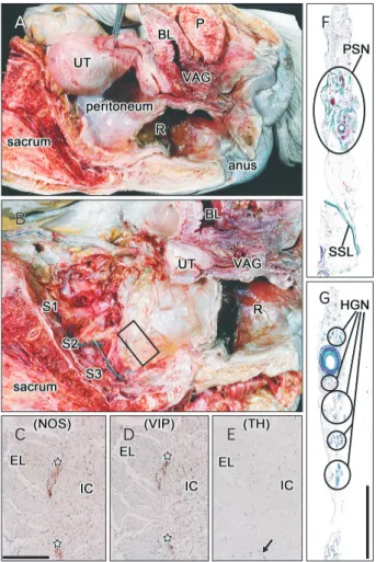Fig. 1. Tissue sampling to prepare his tological sections of the pelvic  spla nchnic nerve (PSN) from the left he mipelvis of a 78-year-old wo­