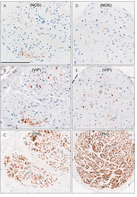 Fig. 2. Nerve bundles comprising the  hypogastric nerve in a 78­year­old man. 