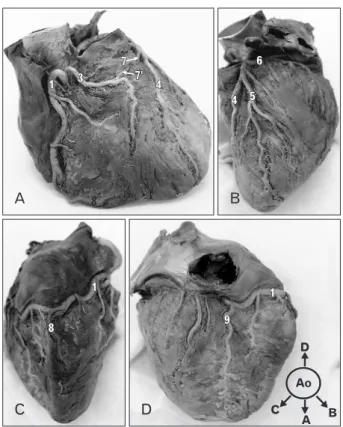 Fig. 1. Superior view of the great vessels and the coronary arteries. 