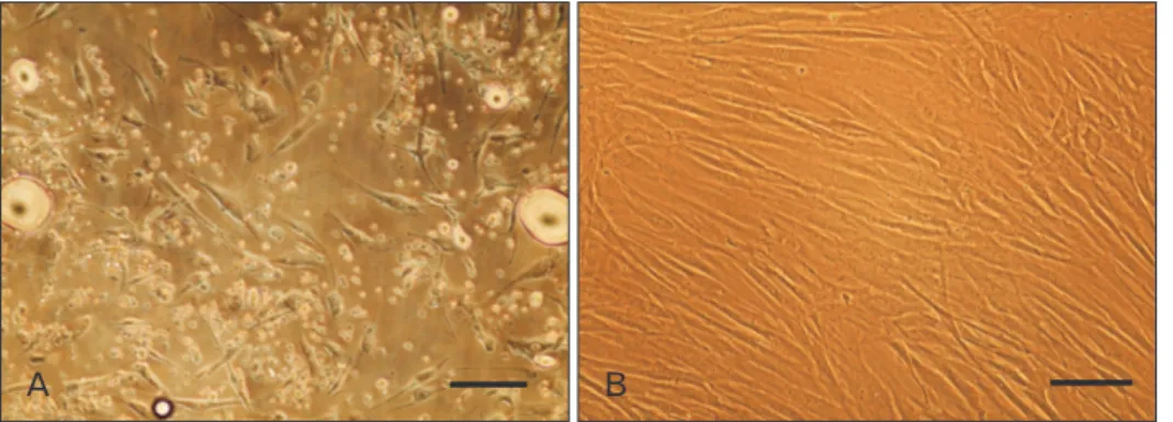 Fig. 1. Adipose-derived stem cells (ASCs)  isolation and culture. (A) Cultured cells of  stromal vascular fraction of fat tissue on  day 3 of primary culture