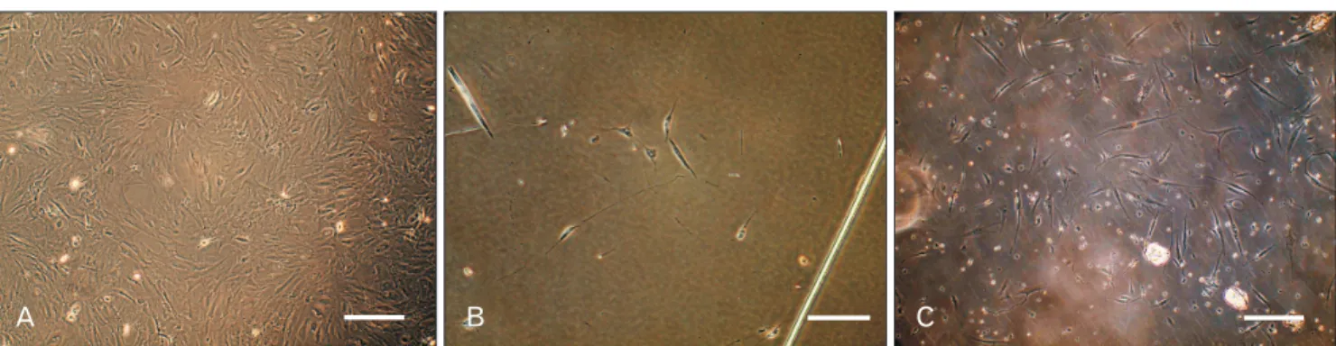 Fig. 4. Immunofluorescence staining in- in-dicated that the differentiated  Schwann-like cells expressed S100 (A, C) and glial  fibrillary acidic protein (GFAP) (B, D)  in both human serum (HS)- and fetal  bovine serum (FBS)-treated groups