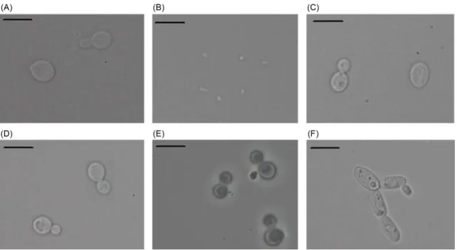 Fig. 2. Morphological characterization of three isolates of yeasts (Scale bar = 2 µm)