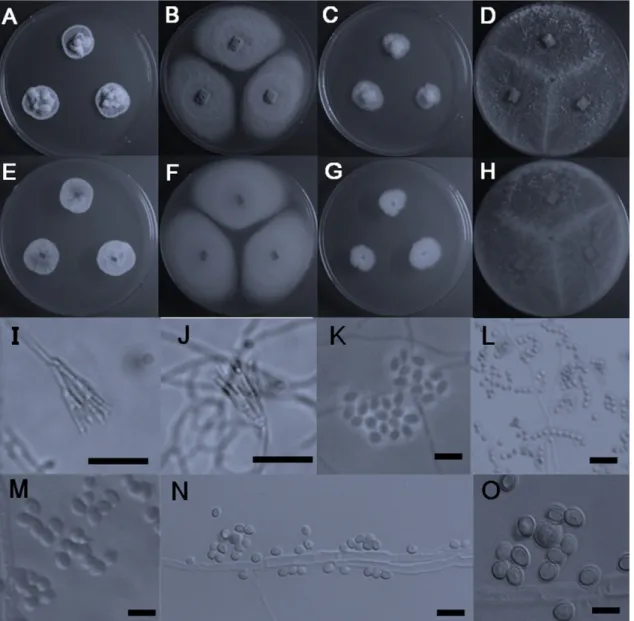 Fig. 2. Colonies of strain 13B011 (T. radicus) grown on PDA (A,E) for 7 days at 25 o C