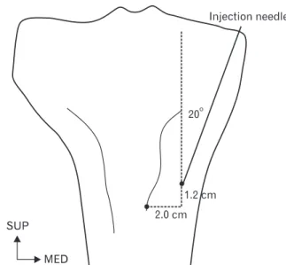 Fig. 6.  The distribution of nerves and vessels in the anserine bursa. 
