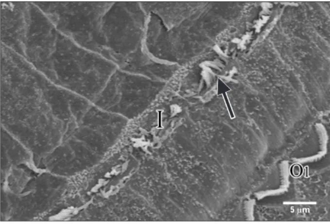 Fig. 14. Scanning electron microscopy of the reticular lamina of  group IIB, showing frequent large blebs (arrowheads) arising from the  cuticular plates of inner hair cells (×2,000).