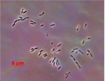 Table 3. Suppression of downy mildew on the cucumber leaf disk treated with B.amyloliquefaciens CC110 cultured on various media