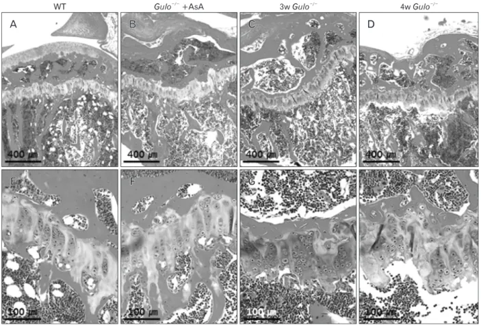 Fig. 5. The proximal metaphysis and growth plate of the proximal tibia after ascorbic acid withdrawal