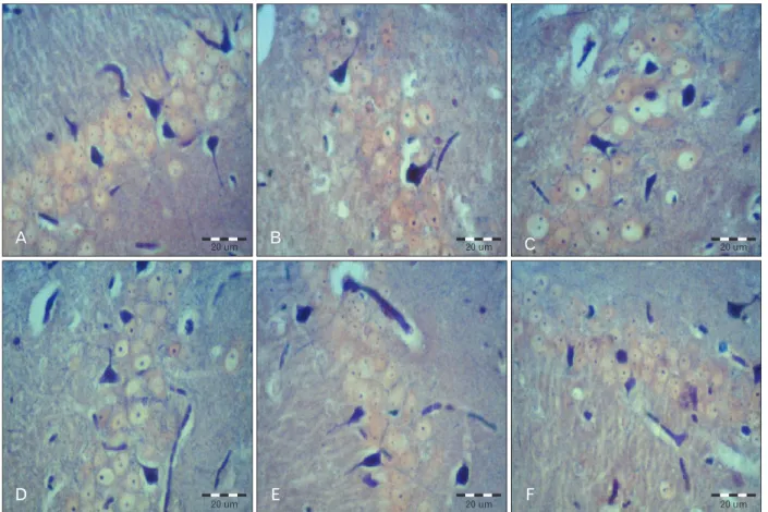 Fig. 1. Astrocytes in the CA1 area of the hippocampus in all groups. (A) Control. (B) Sham (scopolamine)