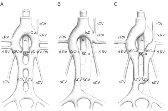 Fig. 2.  Drawing of the development  of the renal vein. (A) Renal venous  collar at 8 week of embryogenesis