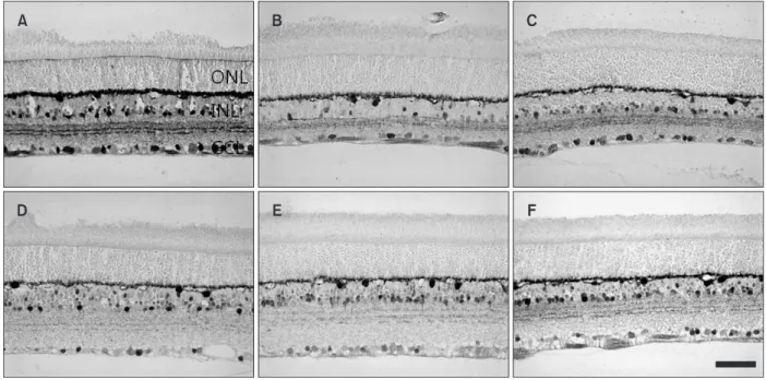 Fig. 2.  Quantitative analysis of the number of calbindin D28K- D28K-immunoreactive neurons in the ganglion cell layer in the retinas at  normal (N) and at 1 day (1D), 3 days (3D), 7 days (7D), and 14 days  (14D) after both elevation of intraocular pressur
