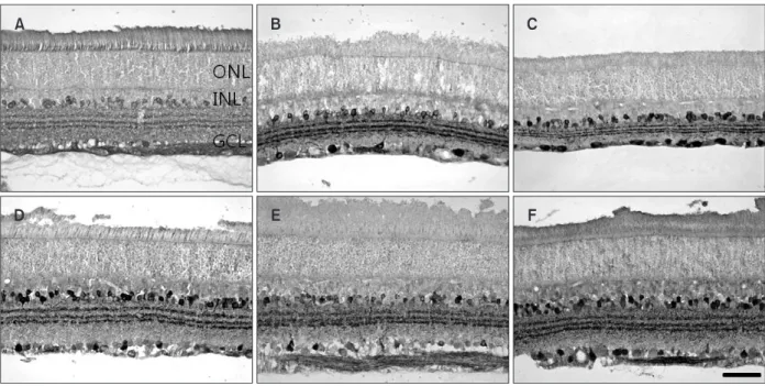 Fig. 3. Light micrographs showing immunohistochemical changes in the retina taken from normal (A), 1 day (B) and 14 days (C) after elevation  of intraocular pressure, and 3 days (D), 7 days (E), and 14 days (F) after middle cerebral artery occlusion, which
