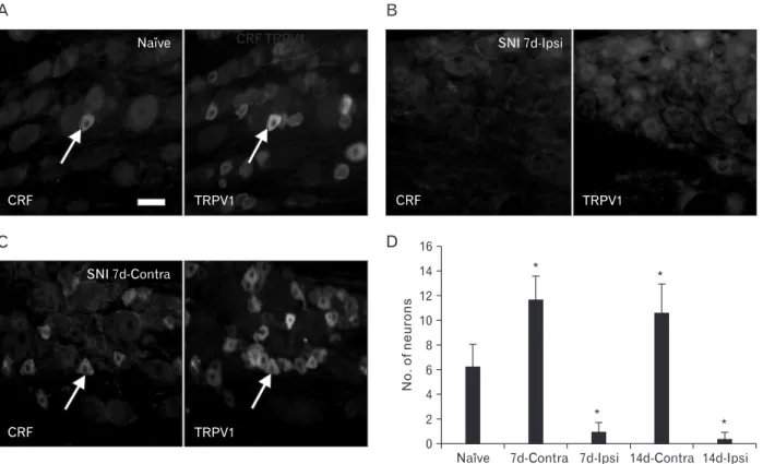 Fig. 2. Corticotropin-releasing factor (CRF) and transient receptor potential vanilloid 1 receptor (TRPV1) expression in the L5 dorsal root  ganglion (DRG) of the naїve and spinal nerve injury (SNI) rats