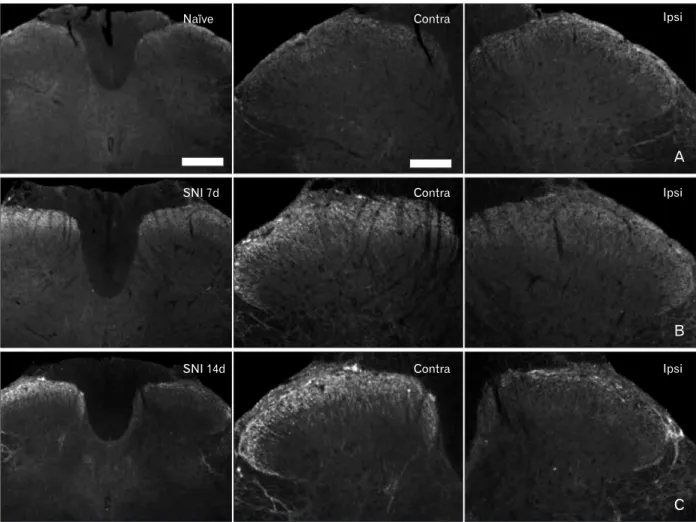 Fig. 3. Corticotropin-releasing factor (CRF) expression in the spinal dorsal horn in the naїve and spinal nerve injury (SNI) group rats