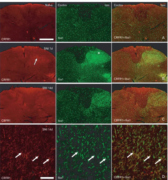 Fig. 4. Corticotropin-releasing factor receptor type 1 (CRFR1) expression in the Iba1-positive microglia in the spinal dorsal horn