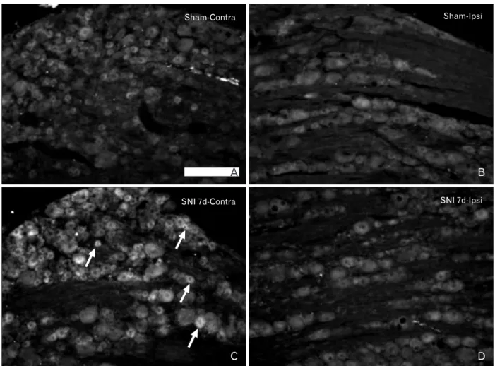 Fig. 5. Expression of corticotropin-releasing factor receptor type 2 (CRFR2) in the L5 dorsal root ganglion (DRG) of the sham control and spinal  nerve injury (SNI) group rats
