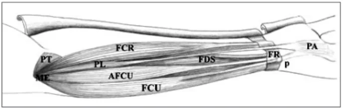 Fig. 1. A dissection of the forearm and carpus in one left upper  extremity. Th   e other muscles have been refl ected to show the accessory  muscle