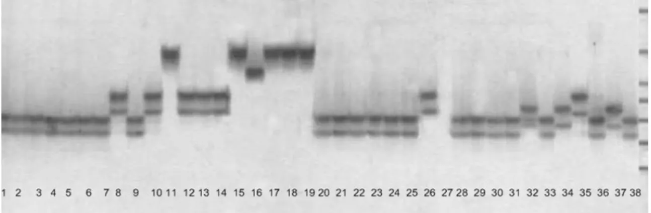 Fig. 1. Polymorphic pattern of an SSR marker, RM270. Refer to the Table 1 for the lane designation