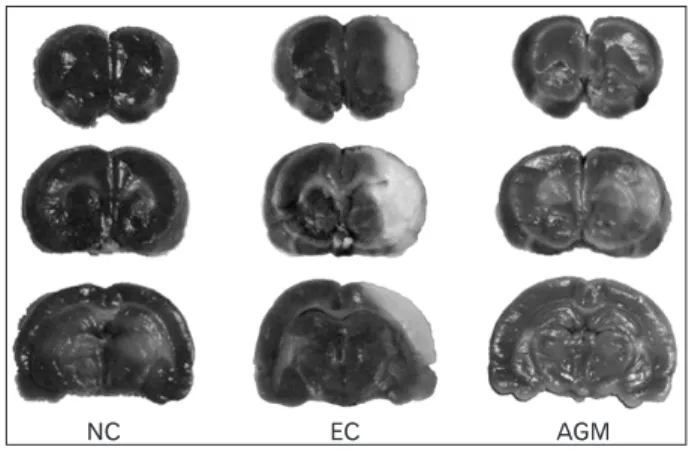 Table 1. Infarction area of the brain 23 hours after transient cerebral  ischemia Groups Contralateral  hemisphere (%) Ipsilateral  hemisphere (%) Infarctionarea (%) Normal control 49.86±0.98 51.34±2.06 0 Experimental control 47.88±0.93 53.29±0.33 15.02±4.