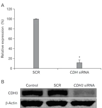 Fig. 1. CDH3 siRNA specifically knock-downed CDH3 expression  level.  48 h following transfection, CDH3 and SCR siRNA-transfected  HuCCT1 cells were collected and RNA and protein were purified