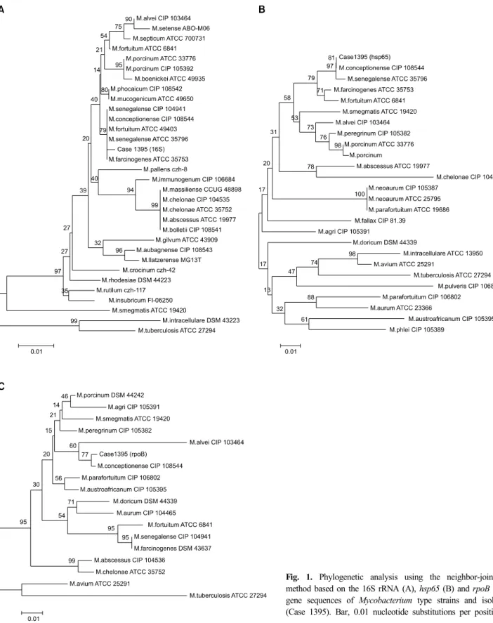 Fig. 1. Phylogenetic analysis using the neighbor-joining  method based on the 16S rRNA (A), hsp65 (B) and rpoB (C)  gene sequences of Mycobacterium type strains and isolate  (Case 1395)