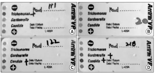 Fig. 3. Gram stained vaginal smear. (A) Gram negative and variable rods on the squamous cells (clue cells) (Gram stain, ×400)