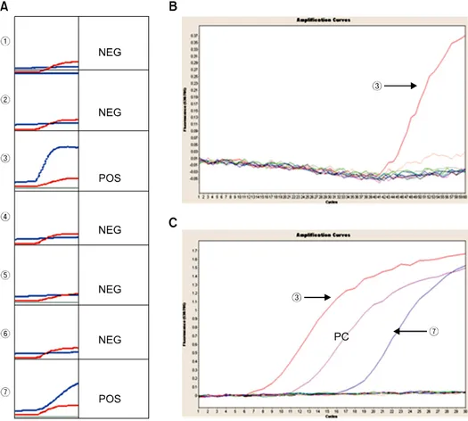 Fig. 1. Detection of enterovirus by  nucleic acid sequence-based  amplifi-cation and real-time nested reverse  transcription PCR