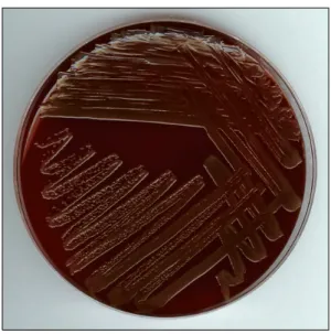 Fig. 2. Microscopic finding of Microbacterium oxydans isolated from the case showing short and slightly bent gram-positive bacilli (×1,000).
