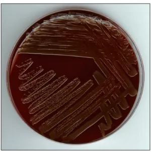 Fig. 2. Microscopic finding of Microbacterium oxydans isolated from the case showing short and slightly bent gram-positive bacilli (×1,000).