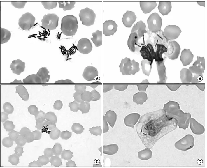 Fig. 2. Microorganisms shown on peripheral blood smears. (A) Extracellular clustering bacilli and anisocytosis and poikilocytosis of RBCs on peripheral blood smear (Wright stain, ×1,000)