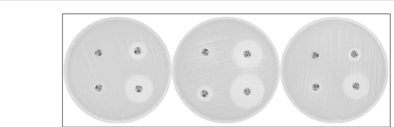 Fig. 1. Representative results using the Clinical and Laboratory Standards Institute extended-spectrum β-lactamase (ESBL) confirmatory test and AmpC disk test without and with boronic acid (two disks positioned in right side on media)