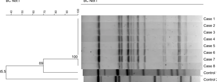 Fig. 2. PFGE patterns  of emetic toxin producing B. cereus isolated from patients of the outbreak