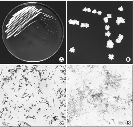 Fig. 1. Macroscopic and microscopic features of strain 3617-1 (this case). (A) Growth of strain 3617-1 at 24 h on sheep’s blood agar plates  (BAP)