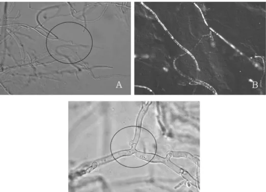 Fig. 1. Photomicrographs about di-mon method procedure of  L. edodes  to make new strain, KFRI 961; dikaryon of strain KFRI 13(A), monokaryon of strain KFRI 535(B) and new dikaryon of strain KFRI 961(C)